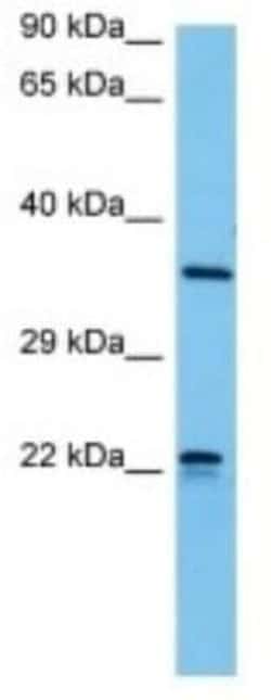 Olfactory receptor 510 Rabbit anti-Mouse, Polyclonal, Novus Biologicals 100 &mu;g | Buy Online | Novus Biologicals | Fisher Scientific